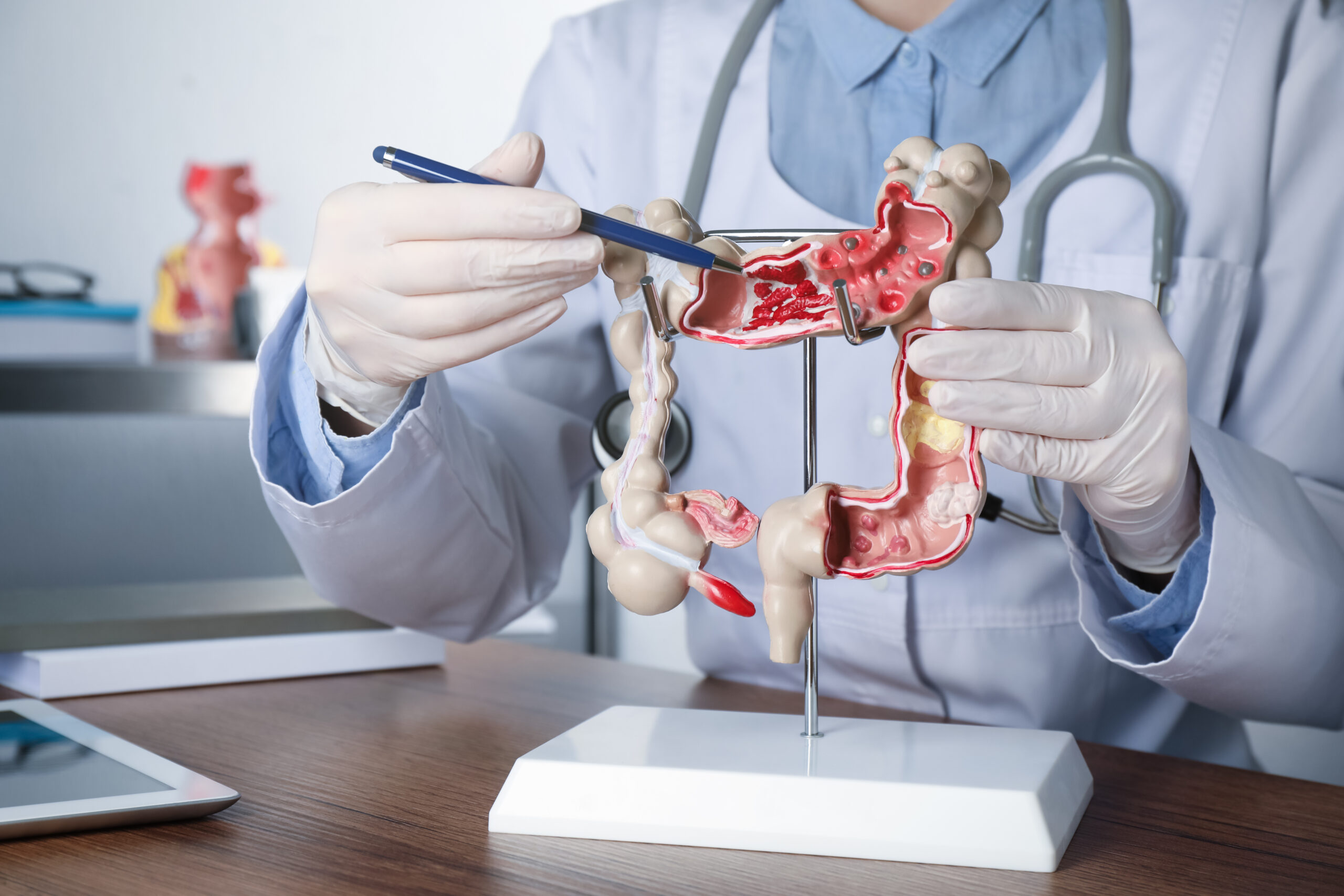 Gastroenterologist showing human colon model at table in clinic,